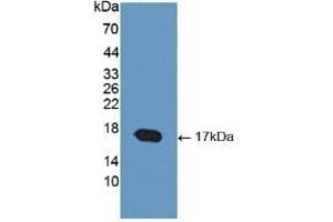 Detection of Recombinant COMP, Human using Polyclonal Antibody to Cartilage Oligomeric Matrix Protein (COMP) (COMP Antikörper  (AA 123-240))