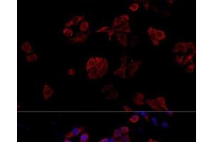 Immunofluorescence analysis of HeLa cells using CD40L Polyclonal Antibody at dilution of 1:100. (CD40 Ligand Antikörper)