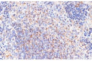 Immunohistochemistry of paraffin-embedded Rat spleen using PDGFR beta Polyclonal Antibody at dilution of 1:100 (40x lens). (PDGFRB Antikörper)