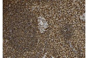 ABIN6277088 at 1/100 staining Mouse spleen tissue by IHC-P. (Progesterone Receptor Antikörper  (Internal Region))