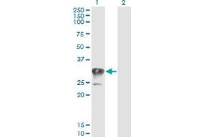 Western Blot analysis of CCS expression in transfected 293T cell line by CCS monoclonal antibody (M03), clone 1E2.