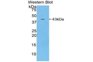 Western Blotting (WB) image for anti-Interleukin 12 Receptor, beta 2 (IL12RB2) (AA 559-647) antibody (ABIN3207281) (IL12RB2 Antikörper  (AA 559-647))