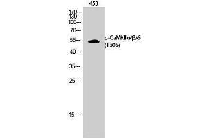 Western Blotting (WB) image for anti-CaMKIIalpha/beta/delta (pThr305) antibody (ABIN3182178) (CaMKIIalpha/beta/delta (pThr305) Antikörper)