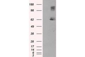 Image no. 5 for anti-Lipase, Endothelial (LIPG) antibody (ABIN1499166) (LIPG Antikörper)