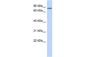 APBB2 antibody used at 1 ug/ml to detect target protein.
