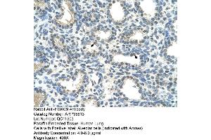 Human Lung (HOXC9 Antikörper  (Middle Region))