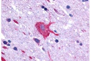 Anti-LGR4 antibody  ABIN1049006 IHC staining of human brain, neurons and glia.