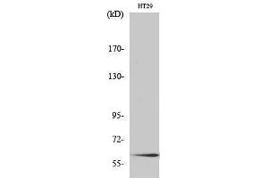 Western Blotting (WB) image for anti-SMAD, Mothers Against DPP Homolog 2 (SMAD2) (Ser795) antibody (ABIN3186984) (SMAD2 Antikörper  (Ser795))
