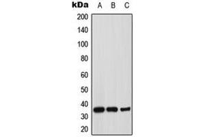 Western blot analysis of Syntaxin 1A expression in MCF7 (A), mouse brain (B), rat brain (C) whole cell lysates. (STX1A Antikörper  (N-Term))