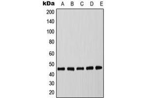 Western blot analysis of C/EBP alpha (pT226) expression in MCF7 EGF-treated (A), mouse spleen (B), mouse liver (C), rat spleen (D), rat liver (E) whole cell lysates.