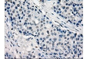 Image no. 9 for anti-Interferon Regulatory Factor 3 (IRF3) antibody (ABIN1498899) (IRF3 Antikörper)