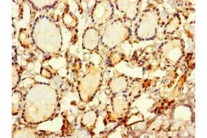 Immunohistochemistry of paraffin-embedded human thyroid tissue using ABIN7169648 at dilution of 1:100 (SRP19 Antikörper  (AA 2-144))