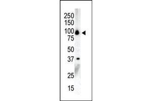 Western blot analysis of anti-PKCnu C-term Pab in NCI-H460 cell lysate. (PRKD3 Antikörper  (C-Term))