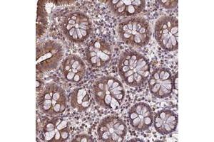 Immunohistochemical staining of human colon with DMRTA2 polyclonal antibody  shows moderate cytoplasmic positivity in glandular cells at 1:20-1:50 dilution. (DMRTA2 Antikörper)