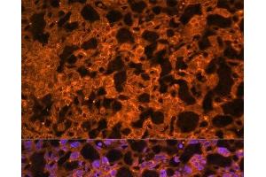 Immunofluorescence analysis of Mouse placenta using LAIR2 Polyclonal Antibody at dilution of 1:100.