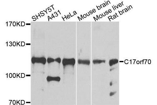 C17orf70 Antikörper  (AA 652-881)