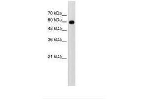 Image no. 1 for anti-Cell Division Cycle 23 (CDC23) (AA 101-150) antibody (ABIN203478) (CDC23 Antikörper  (AA 101-150))