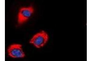 Immunofluorescent analysis of GAP43 (pS41) staining in SHSY5Y cells. (GAP43 Antikörper  (N-Term, pSer41))