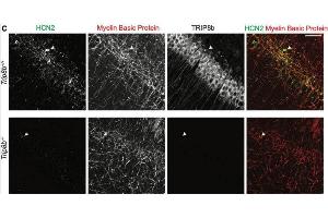 anti-Peroxisomal Biogenesis Factor 5-Like (PEX5L) (AA 1-192), (Constant Region) antibody