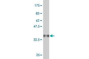 Western Blot detection against Immunogen (36. (PET112L Antikörper  (AA 466-556))