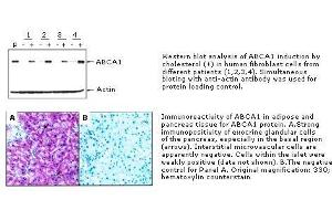 Immunohistochemistry (IHC) image for anti-ATP-Binding Cassette, Sub-Family A (ABC1), Member 1 (ABCA1) antibody (ABIN187475) (ABCA1 Antikörper)
