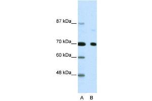 WB Suggested Anti-NCOR2  Antibody Titration: 2. (NCOR2 Antikörper  (N-Term))