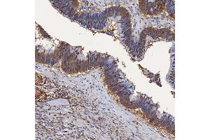 IHC analysis of SBP/SELENBP1 using anti-SBP/SELENBP1 antibody (ABIN7600755). (SELENBP1 Antikörper  (AA 23-462))
