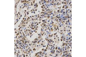 Immunohistochemistry (IHC) image for anti-Histone H4 (2meArg3) antibody (ABIN1872990)