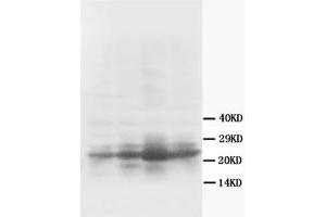Western Blotting (WB) image for anti-Growth Associated Protein 43 (GAP43) antibody (ABIN1107311) (GAP43 Antikörper)