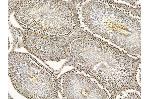 ABIN7095262 and ABIN7099319 at 1/100 staining rat testis tissue by IHC-P. (ZFR Antikörper)