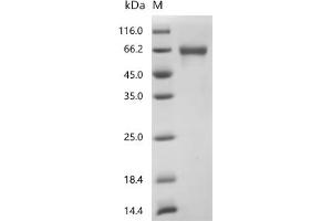 Furin (Paired Basic Amino Acid Cleaving Enzyme) (FURIN) (AA 27-574) protein (His tag)