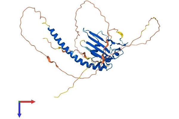 TSPYL1 Protein (AA 1-379) (His tag)