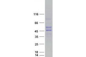 Western Blotting (WB) image for Ring Finger Protein 39 (RNF39) (Transcript Variant 1) protein (Myc-DYKDDDDK Tag) (ABIN2723195)