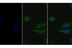 Detection of GSN in Human Hela cell using Polyclonal Antibody to Gelsolin (GSN) (Gelsolin Antikörper  (AA 674-782))
