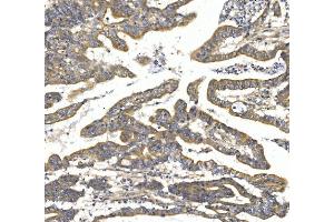 IHC analysis of TTK using anti-TTK antibody (ABIN7601844). (Mps1 Antikörper  (AA 487-821))