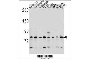 Western blot analysis in mouse NIH-3T3,Neuro-2a cell line and mouse stomach tissue and U251,A2058,A375,Sk-Br-3,T47D cell line lysates (35ug/lane).