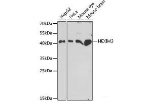 Western blot analysis of extracts of various cell lines using HEXIM2 Polyclonal Antibody at dilution of 1:1000. (HEXIM2 Antikörper)