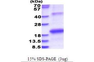 HCV E2 Protein (AA 2634-2752) (His tag)
