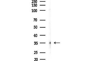 Western blot analysis of lysates from HepG2 cells(LPS,4h treatment), using TIS11B Antibody at 1/1000 dilution.