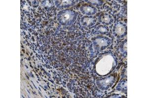 IHC analysis of U2AF65/U2AF2 using anti U2AF65/U2AF2 antibody (ABIN7600795).