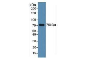 Detection of MAPT in Human Hela Cells using Polyclonal Antibody to Tau Protein (MAPT) (tau Antikörper  (AA 130-386))