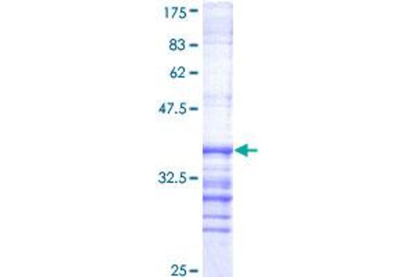 DYRK1A Protein (AA 674-763) (GST tag)