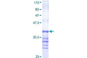 DYRK1A Protein (AA 674-763) (GST tag)