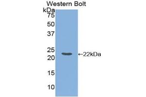 Detection of Recombinant FTL, Equine using Polyclonal Antibody to Ferritin, Light Polypeptide (FTL) (FTL Antikörper  (AA 1-175))