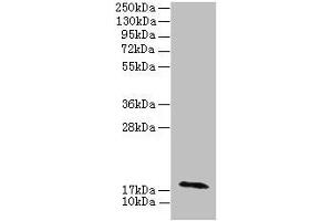 Western blot All lanes: RPP21 antibody at 12 μg/mL + Colo320 whole cell lysate Secondary Goat polyclonal to rabbit IgG at 1/10000 dilution Predicted band size: 18, 21, 17, 19 kDa Observed band size: 18 kDa (RPP21 Antikörper  (AA 2-154))