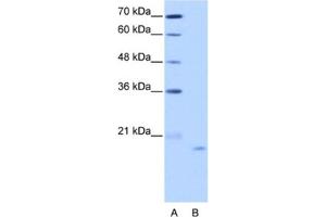 Western Blotting (WB) image for anti-Nucleolar Protein 6 (NOL6) antibody (ABIN2462296) (Nucleolar Protein 6 Antikörper)