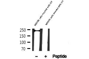 Western blot analysis of extracts of M059K cells treated with UV, using Phospho-NuMA (Ser395) Antibody.