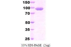 Figure annotation denotes ug of protein loaded and % gel used. (Dipeptidyl-Peptidase 4 (DPP4) (AA 39-766) peptide (His tag))