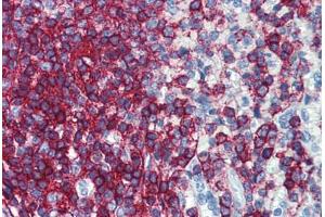 Human Spleen: Formalin-Fixed, Paraffin-Embedded (FFPE) (CD44 Antikörper  (FITC))