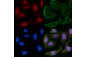 ABIN6255183 and ABIN6266461 staining Hela cells by IF/ICC.